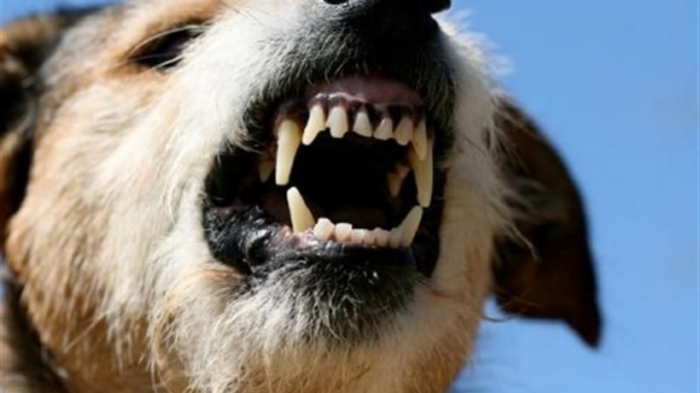 По делу о нападении собак на школьницу назначены медицинская и биологическая судебные  экспертизы