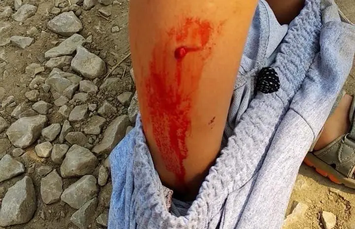 Следствие выясняет обстоятельства нападения собак на ребенка в районе «Птицефабрика»