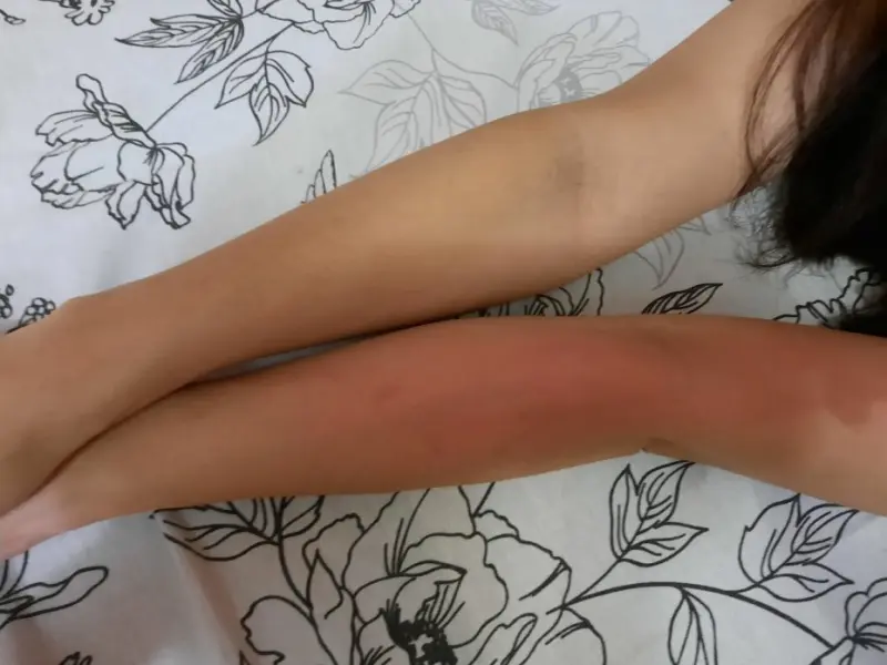 Ожоги, деньги и прорванный стояк: В одной из новостроек Якутска ошпарило новоселов