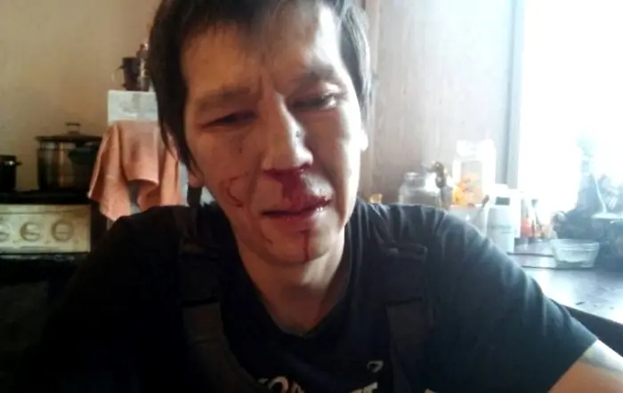По факту избиения Александра ЯКНК возбуждено уголовное дело