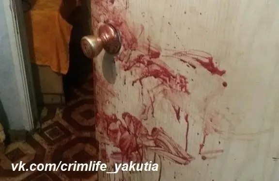 Пожилая женщина покусанная собственной собакой находится в реанимации