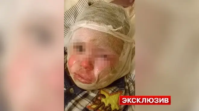 В фирме «Росденьги» рассказали, почему коллекторы сожгли ребёнка
