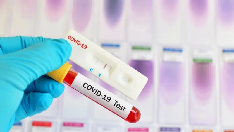 125 новых случаев COVID-19 выявлено в Якутии