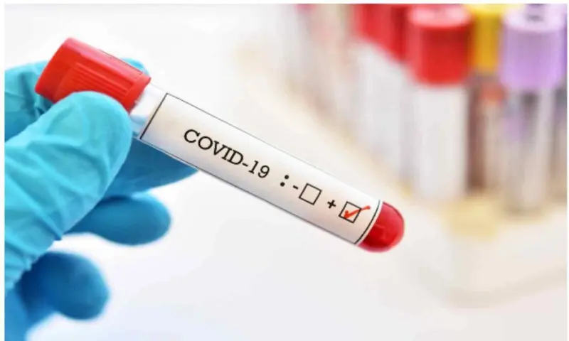 263 новых случаев COVID-19 из 3892 исследований выявлено в Якутии