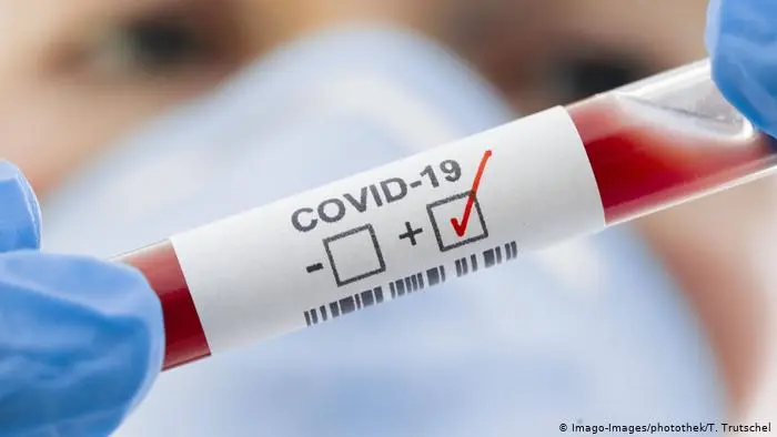 280 новых случаев COVID-19 из 4136 исследований выявлено в Якутии