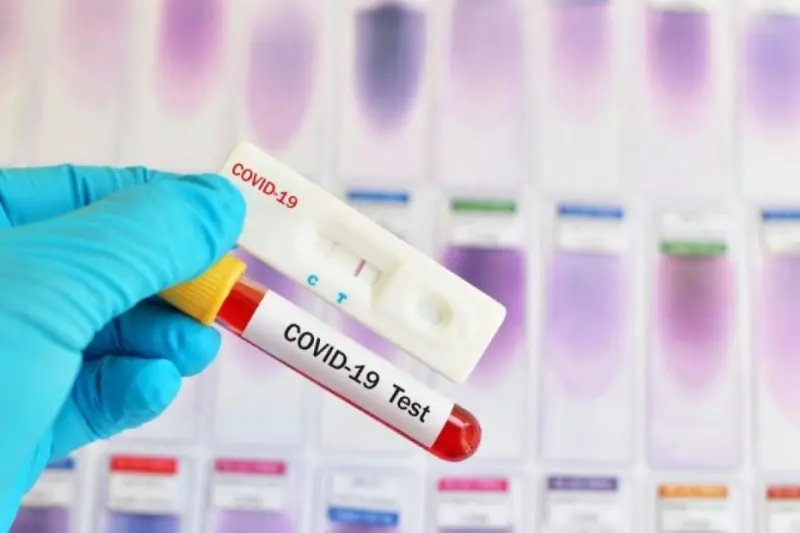 261 новый случай COVID-19 выявлен в Якутии