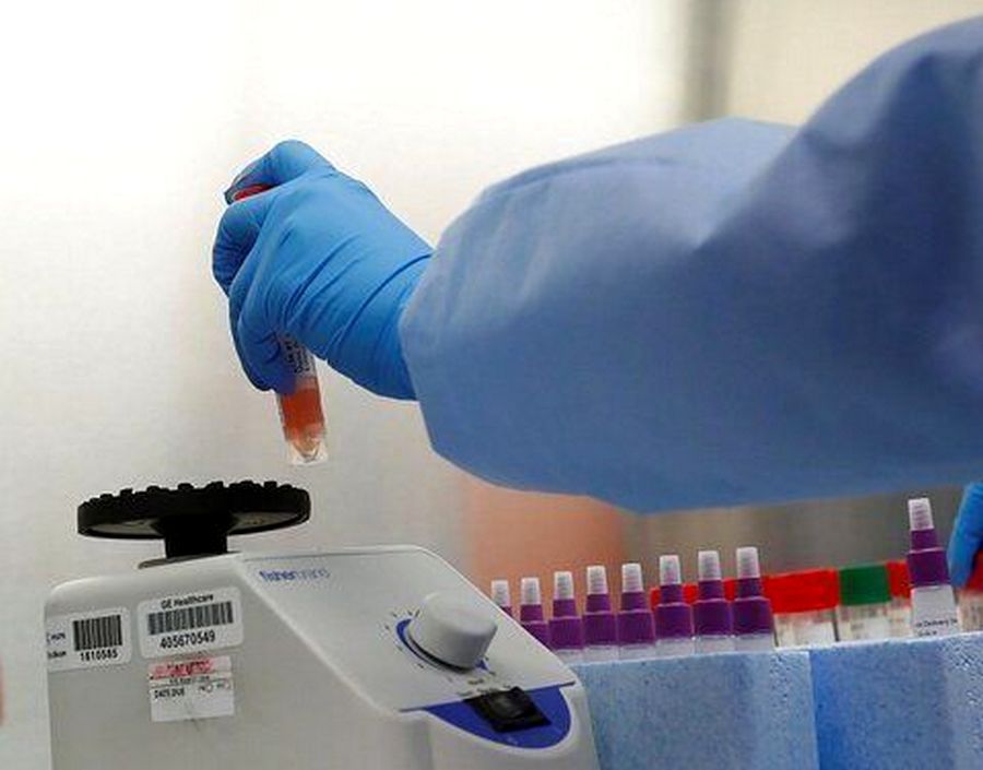 В Якутии за сутки выявлено 93 новых случая коронавируса, летальных исходов нет