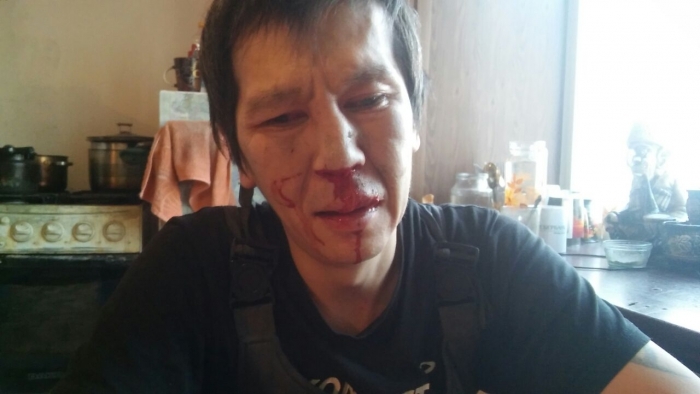 Общественников бьют! Александра ЯКНК-Захарова избили из-за спорной трансформаторной подстанции