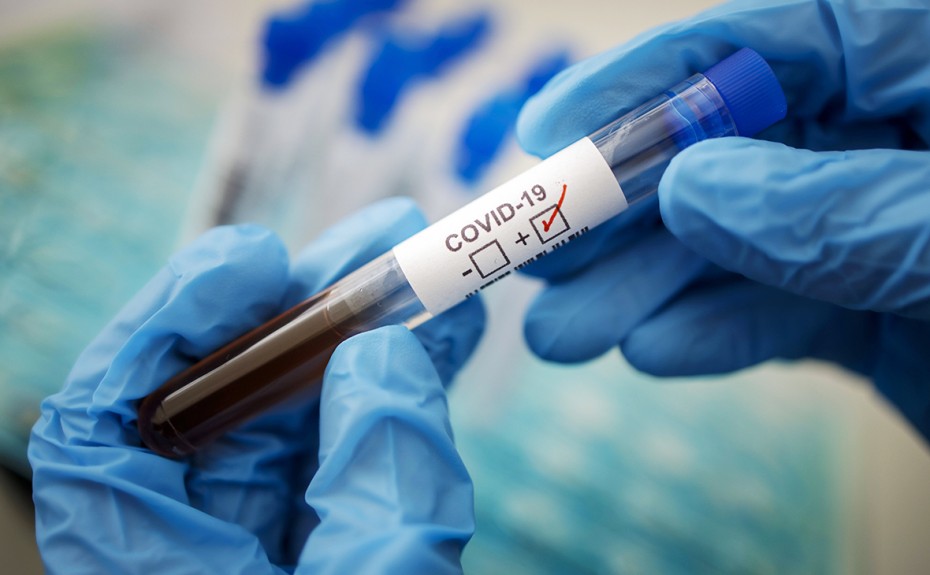 146 новых случаев коронавирусной инфекции выявлено в Якутии