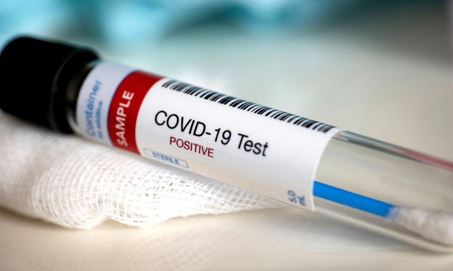 99 случаев заболевания COVID-19 выявлено в Якутии по состоянию на 5 мая