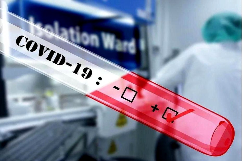 140 случаев заболевания COVID-19 зарегистрировано в Якутии