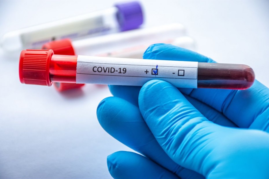 225 новых случаев COVID-19 выявлено в Якутии по результатам 5 522 исследований