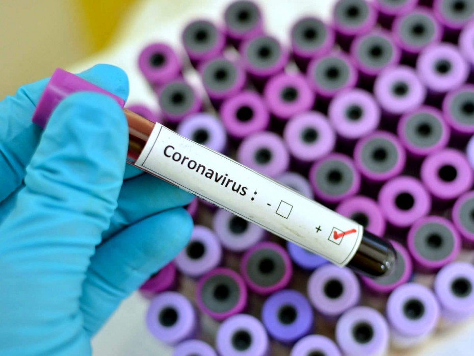 На 29 ноября в Якутии выявлено 254 новых случая коронавирусной инфекции