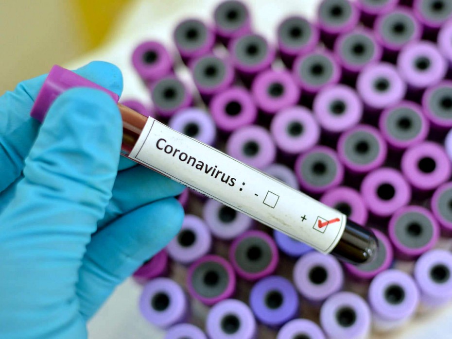 На 7 декабря в Якутии выявлено 242 новых случая коронавирусной инфекции