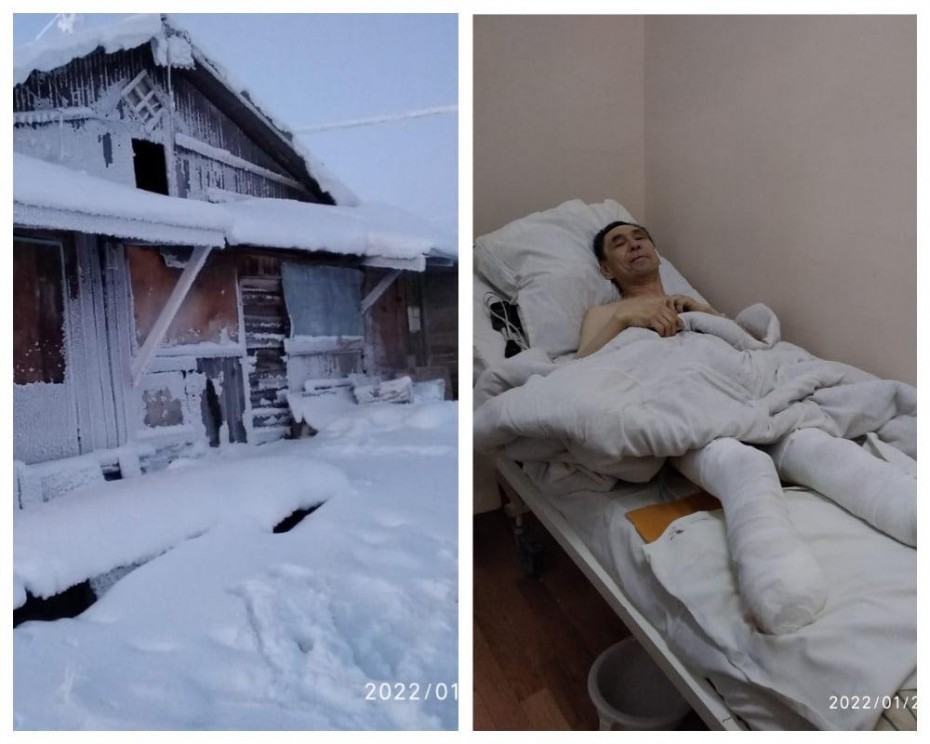Прокуратура организовала проверку по факту обморожения ног инвалидом в аварийном доме в поселке Чокурдах